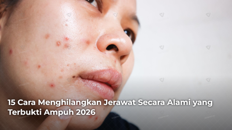 15-cara-menghilangkan-jerawat-secara-alami-yang-terbukti-ampuh-2026